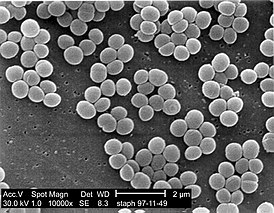 Микрофотография возбудителя инфекции (Staphylococcus aureus).