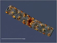 Star stick diatom Star stick diatom.jpg