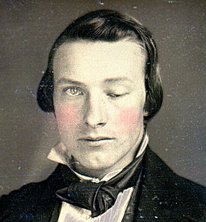 1852 ptosis patiënt.jpg