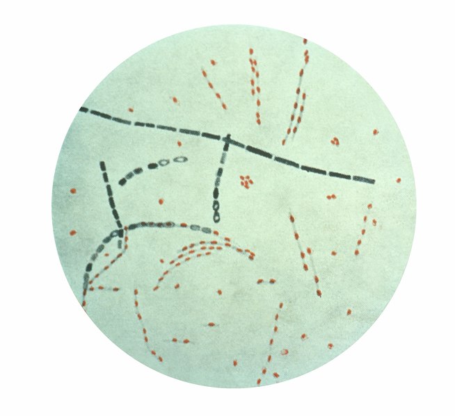 File:Bacillus anthracis PHIL 1792.tif