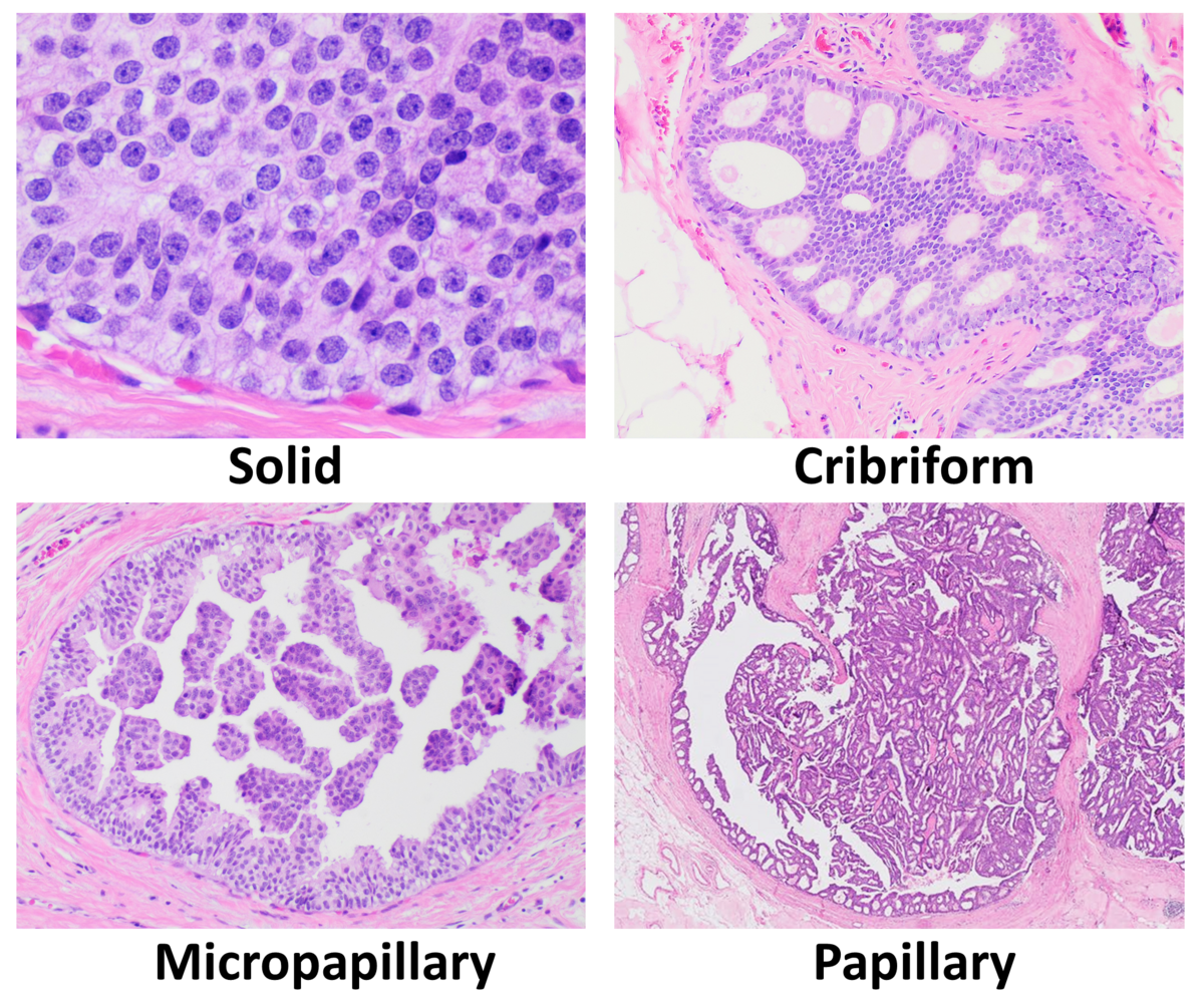 File:Normal breast histology.png - Wikipedia