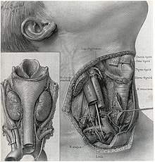 Процедура на тиреоидектомия - хирургична анатомия