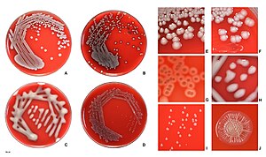 Escherichia coli on agar