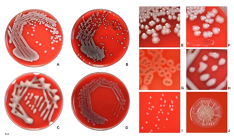 E. coli on sheep blood agar.