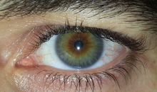 Olhos masculinos de cores diferentes