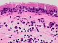 Intermediate-high magnification, including respiratory epithelium