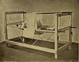 Patient in a symphysiotomy hammock after surgery, 1907 Postoperative treatment; an epitome of the general management of postoperative care and treatment of surgical cases as practised by prominent American and European surgeons (1907) (14762160486).jpg