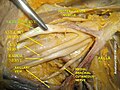 Median nerve