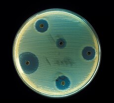 Staphylococcus aureus (AB Test).jpg
