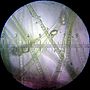 Thumbnail for File:20100422 235222 Cyanobacteria.jpg