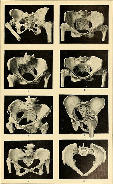 File:An American text-book of obstetrics. For practitioners and students (1897) (14581593337).jpg