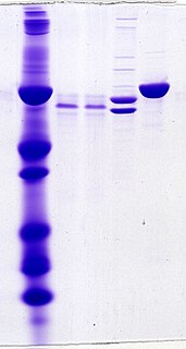 <span class="mw-page-title-main">Gel electrophoresis of proteins</span>