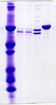 Thumbnail for Gel electrophoresis of proteins