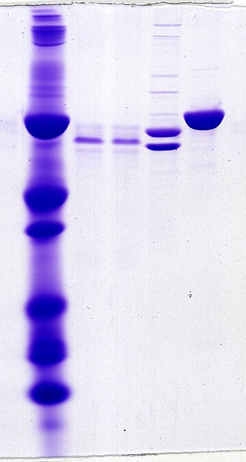 Oligoclonal band