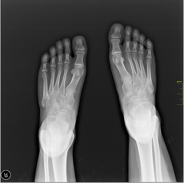 File:Medical X-Ray imaging OVU06 nevit.jpg