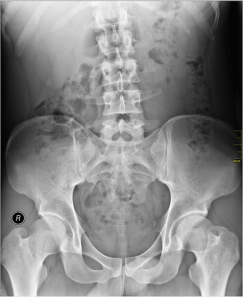 File:Medical X-Ray imaging XKJ07 nevit.jpg