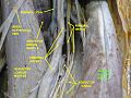 Rectus femoris muscle