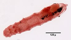 Dinophilus gyrociliatus