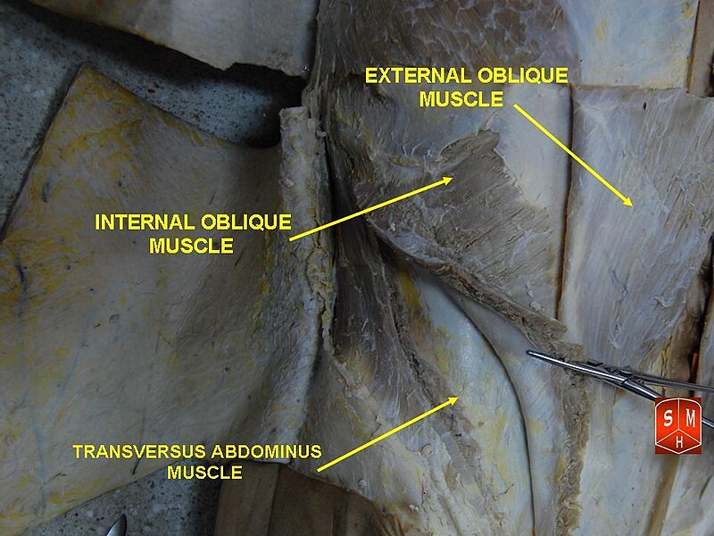 File:External oblique muscle.jpg