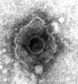 Electron micrograph of a herpesvirus