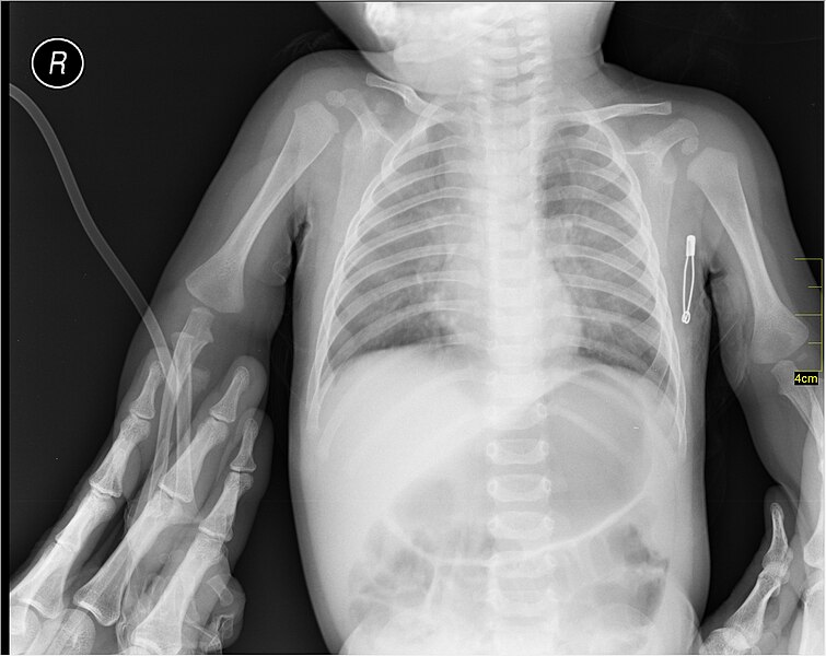 File:Medical X-Ray imaging OCO06 nevit.jpg