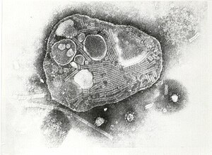 elektronenmikroskopische Aufnahme des Rinderpest-Viruses