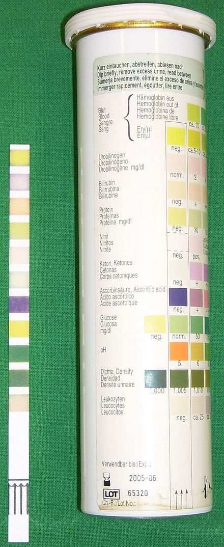 A urine test strip is compared against a color chart to determine the results.