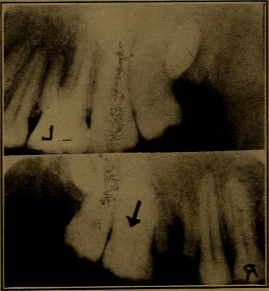 File:X-ray manual - U.S. Army (1917) (14734336166).jpg
