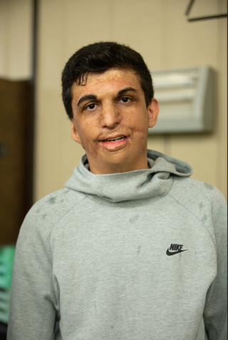 <span class="mw-page-title-main">Youssif (burn victim)</span>