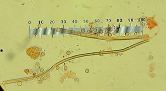 Spores and capillitial threads Calvatia craniiformis 429869.jpg