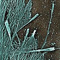 July 28: Electron micrograph showing exaggerated filopodia with club-like shape induced by formin mDia2 in cultured cells