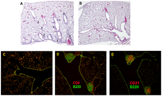 Bronchus-associated lymphoid tissue