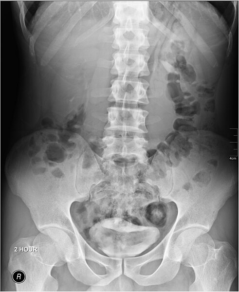 File:Medical X-Ray imaging DAY03 nevit.jpg