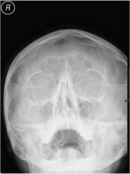 File:Medical X-Ray imaging XET07 nevit.jpg