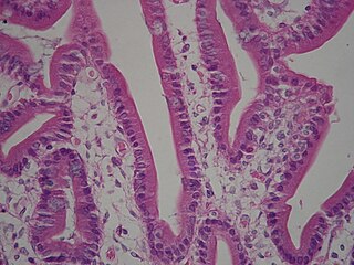 <span class="mw-page-title-main">Brush border</span> Microvilli-covered surface of epithelium found throughout the body