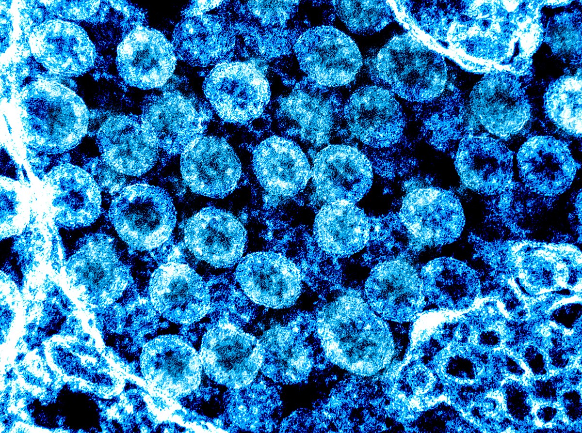 Вирус Covid 19 под микроскопом