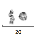 Thumbnail for Ring chromosome 20 syndrome