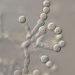 Magnified view of Scopulariopsis brevicaulis, its annellides, and the ring-shaped annellations emanating from them. Scopulariopsis brevicaulis.jpg