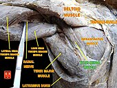 Malý olbý sval (teres minor muscle)