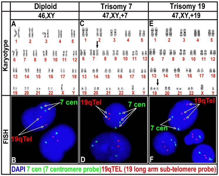 File:Trisomy of chromosome 7 and 19 in human neural progenitor cells cultured in vitro.tif