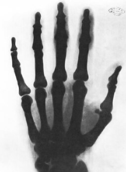 X-ray Tesla took of his hand Rentgenauski zdymak ruki Tesly.jpeg