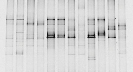 Temperature gradient gel electrophoresis