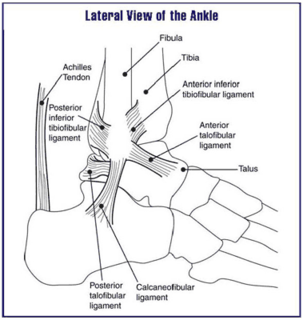 Ankle problems Medical condition