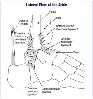 <span class="mw-page-title-main">Ankle problems</span> Medical condition