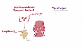 File: video.webm della malattia della valvola aortica