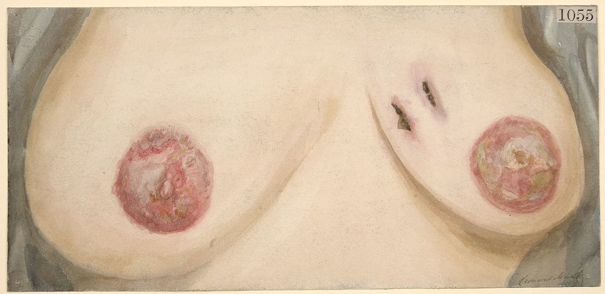 File:Woman small breast, areola and Nipple.png - Wikimedia Commons