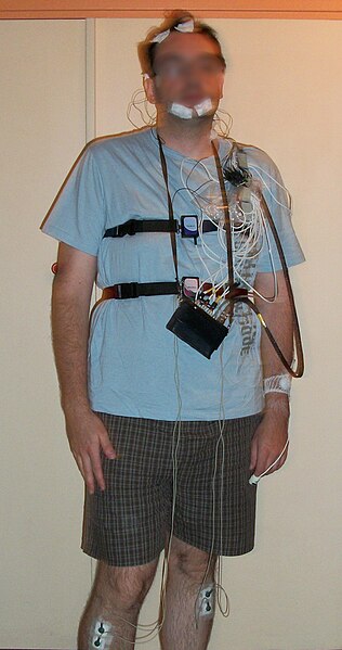 File:Polysmonograpy equipped patient.jpg