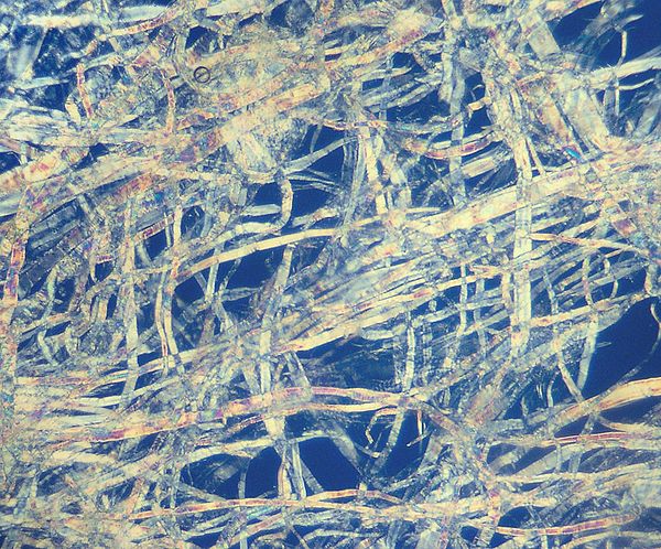 Structure of fibres of pulp