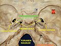 Foramen rotundum