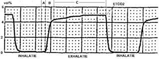 Capnography Monitoring of the concentration of carbon dioxide in respiratory gases